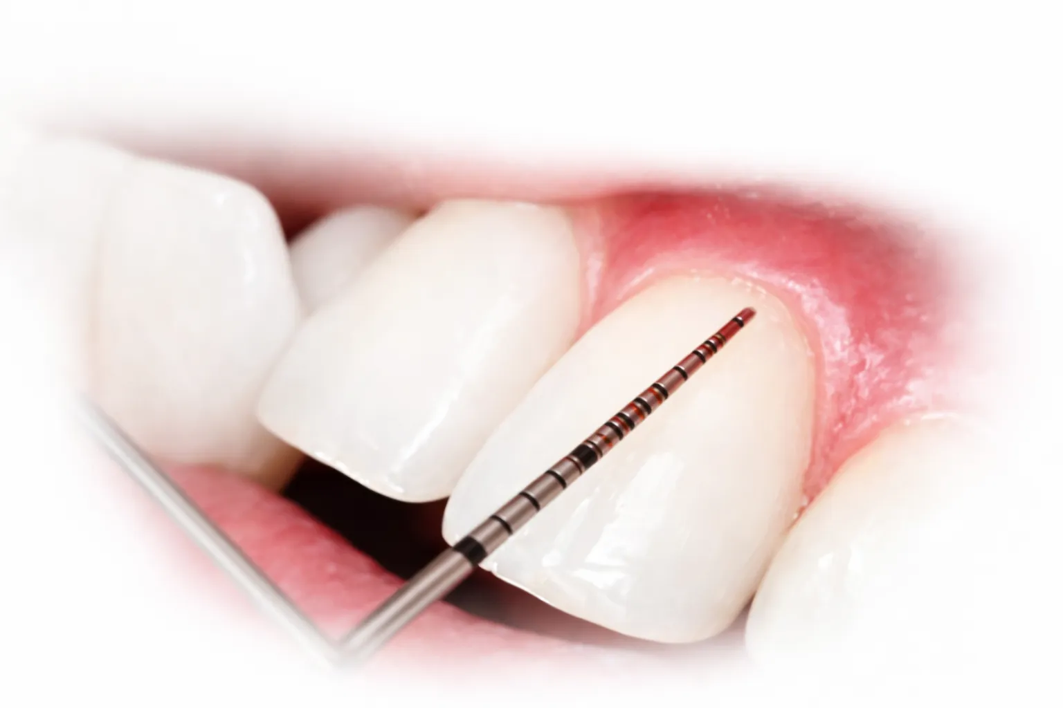 Chirurgia orale e parodontologia a Milazzo