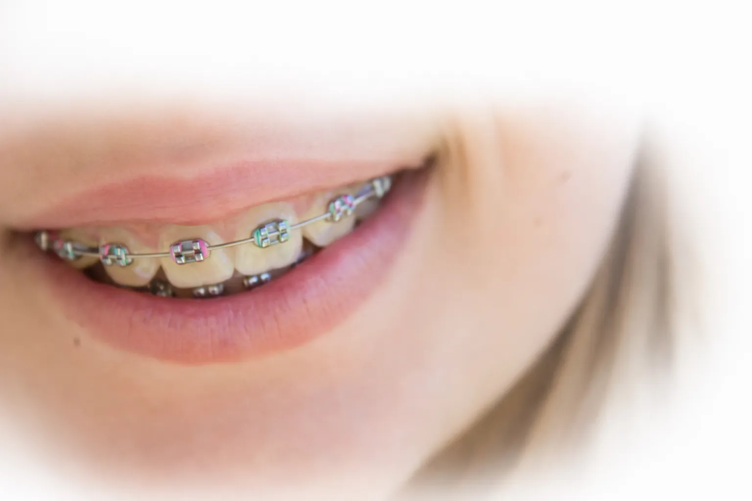 Ortodonzia a Milazzo